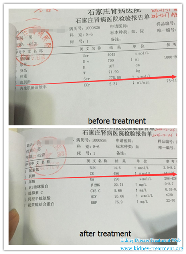 Diabetes with Stage 5 Kidney Disease Can be Controlled by Chinese Medicine