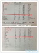 Can Diabetes with Creatinine 766 Get Controlled