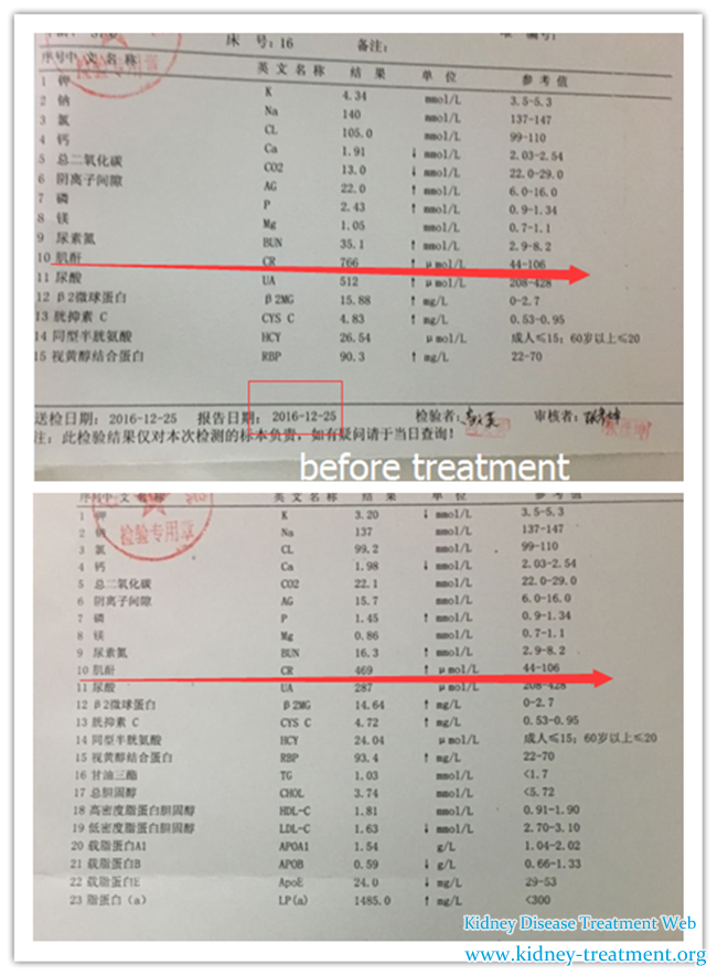 Can Diabetes with Creatinine 766 Get Controlled 