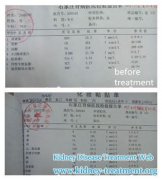 25 Years of Diabetes with High Creatinine Level Got Controlled