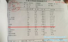 Good News:Diabetic Nephropathy Patient Reduced high Creatinine Remarkably