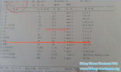  Omani Patient in Shijiazhuang Kidney Disease Hospital