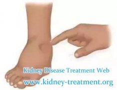 What is Treatment to Remedy Swelling with Hypertensive Nephropathy