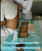 Is It Worth Going Aboard for Micro-Chinese Medicine Osmotherapy