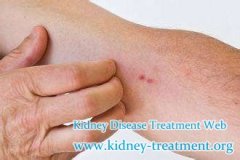 How to Alleviate Itching Skin for Diabetic Nephropathy Patients
