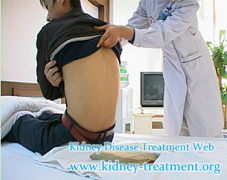 Can I Accept Micro-Chinese Medicine Osmotherapy in Malaysia