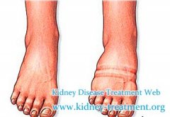Swelling and Chronic Nephritis, What Should We Do
