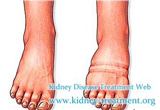 Swelling and Chronic Nephritis, What Should We Do