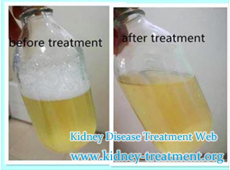 Control Proteinuria for FSGS Patients With Chinese Medicine
