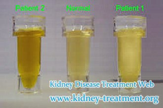 Which Treatment is Better to Foamy Urine in Lupus Nephritis