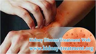 How Do We Treat Itchy Skin with Creatinine 9.2