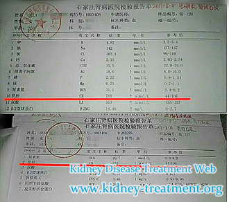How to Reduce Creatinine 768 without Dialysis