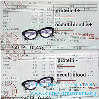 Nephrotic Syndrome: How to Dispel the Proteinuria 4+ and Hematuria 2+