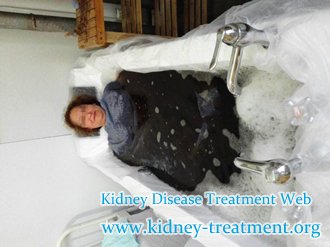 How to Deal With Hypertension Caused by PKD
