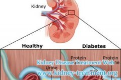 How to Control Urea and Creatinine Serum in Diabetic Nephropathy