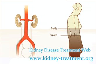 Is There Any Way to Remove Fluid from Lung in Lupus Nephritis with Creatinine 4.3