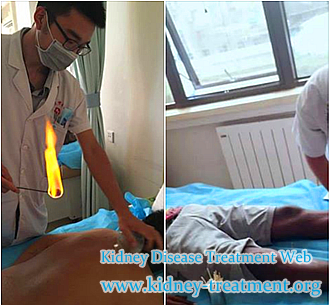 creatinine 8.7, no dialysis, treatment option