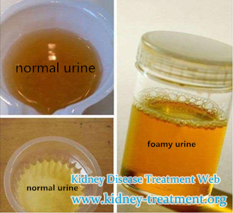 Is There Any Option to Dispel Proteinuria For CKD with Creatinine 493