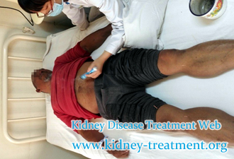 Any Remedy to Lower High creatinine 7.1 and urea level 120