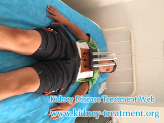 control back pain in PKD, PKD with creatinine 4.5, remedial actions