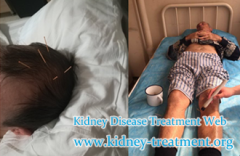 Is There Any Measure to Control Headache for Hypertensive Nephropathy