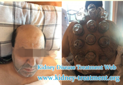 Is It Possible Creatinine 896 and Urea Acid 556 Reduced Without Dialysis