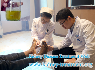 What Medicine is Used to Dispel Bubble In Urine for Nephrotic Syndrome
