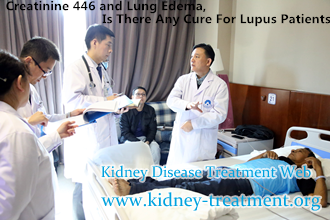 Creatinine 446 and Lung Edema, Is There Any Cure For Lupus Patients