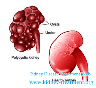 Is There Any Home Remedy To Control Cysts for PKD with Creatinine 340