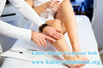 Creatinine 491 and Swollen Legs How Would Chinese Medicine Take Effects