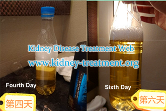 Why Foamy Urine Repeatedly Happens on Nephrotic Syndrome Patients