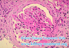 Creatinine 5.9 and Kidney Function 22% Can FSGS Be Restored