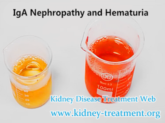 IgA Nephropathy How to Dispel Hematuria Drastically