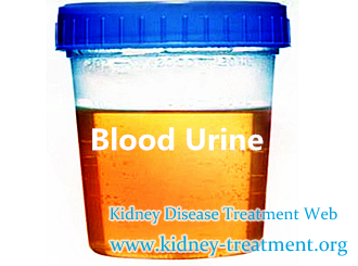 Creatinine Level 2.34 Any Medicine Available for Blood Urine