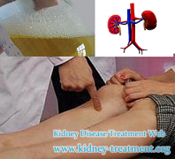 Foamy Urine A Bit But Swollen Feet and Legs Is It Associated to Creatinine 485