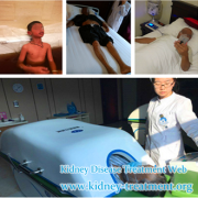 Is Toxin-Removing Therapy Better Than Hormone to Nephrotic Syndrome