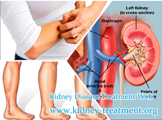 How Can We Deal With Itching and Swelling in Diabetic Nephropathy