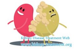 How To Prolong The Life Expectancy Of Transplanted Kidney Patients