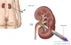 The Relationship Between The Toothache And Kidney