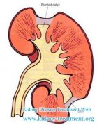 Some Information About The Granular Cast In Kidney Patients