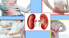 Water Intaking Is Important To Nephritis Patients