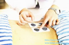 How To Relieve The Leg Swellings Afer Kidney Dialysis