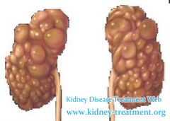Some Reasons Of Polycystic Kidney Should Be Cared