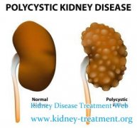 The Characteristics Of Renal Cysts And Reasonable Treatments