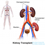 Is It Necessary To Do Renal Puncture For Nephrotic Syndrome?