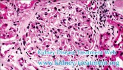 Can IgA Nephropathy Be Cured How Long Can Patients Live